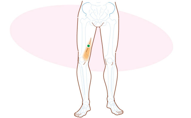 大腿部内側の痛みに関連するトリガーポイント 神門鍼灸整骨院 甲子園院