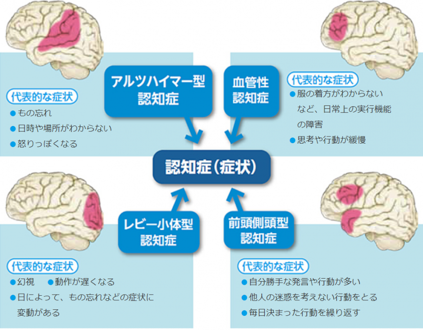 前頭側頭型認知症の危険因子は何ですか?