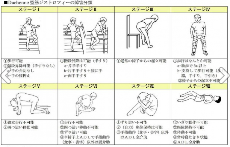 医師はデュシェンヌ型筋ジストロフィーをどのように診断しますか?