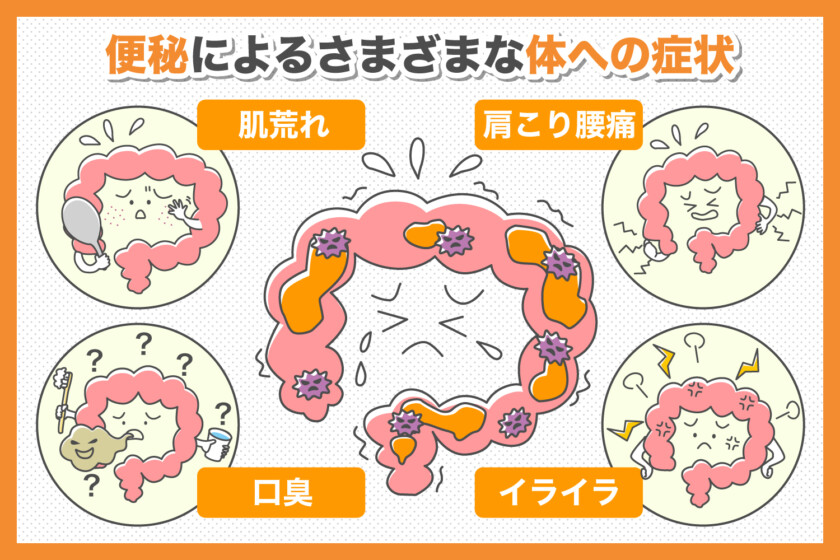 腰痛と便秘の関係とは