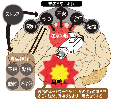 耳鳴り、その不快な音と身体の繋がり